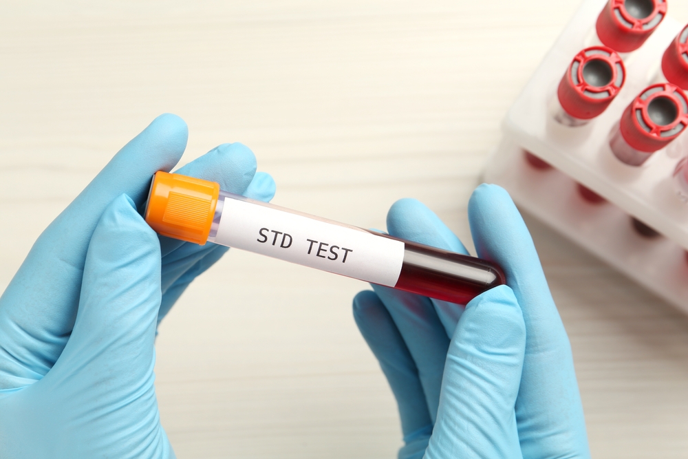 STD Screening